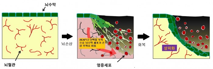 김규원 교수 연구팀이 밝혀낸 뇌수막 회복 원리. 손상된 부위에 산소 공급이 줄어들면서 뇌수막 세포가 이동한다. - 네이처 커뮤니케이션스 제공
