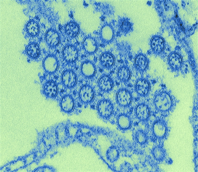 2009년 세계적으로 대유행한 신종플루 H1N1 인플루엔자 바이러스 - 미국 CDC 제공