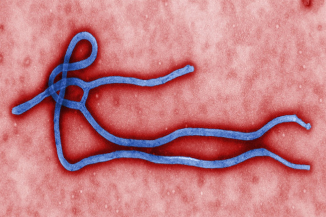 전자현미경으로 촬영한 에볼라 바이러스 - 미국 CDC 제공