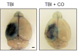 외상후뇌손상(TBI)에 걸린 쥐의 뇌(왼쪽)와 일산화탄소를 투여한 뒤 쥐의 뇌(오른쪽). 검게 손상된 부위가 줄어듬을 알 수 있다. - 강원대 제공