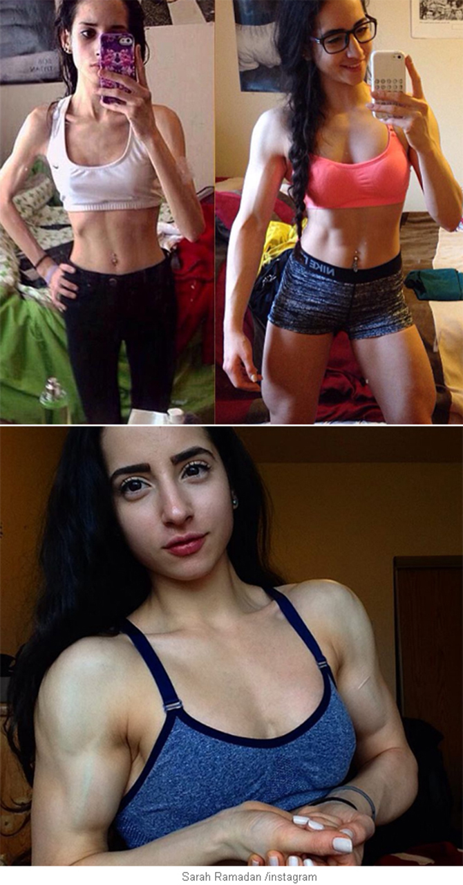 걷지도 못하던 갈비씨 여성의 변신 - 동아사이언스, image size:670x1280