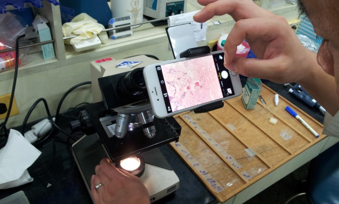 라오스 의사가 휴대폰 거치대를 이용해 현미경 속 세포의 형태를 찍고 있다. 이를 바로 한국 의사에게 전달해 의견을 교환할 수 있다. - 서울대 제공