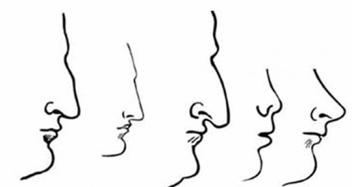 인류에게서 가장 널리 발견되는 코의 유형 5가지. - 두개안면성형외과학회지 제공