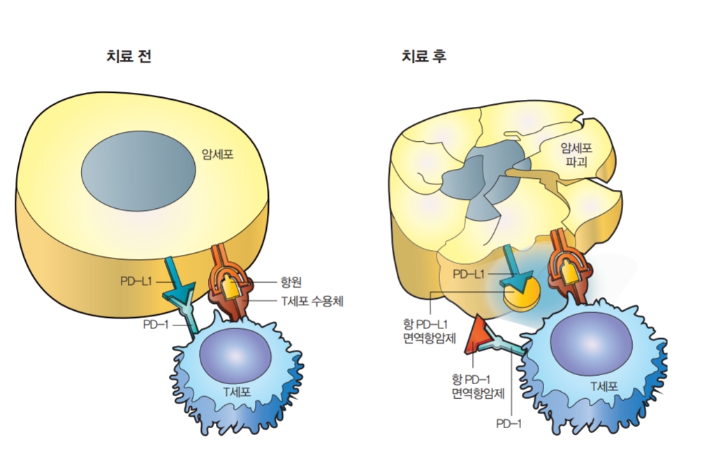 면역항암제 치료방법. 암세포는 체내 면역체계를 피해 증식한다. 암세포 표면에 있는 단백질이 면역세포인 T세포와 결합해 T세포의 기능을 떨어뜨린다(왼쪽). 그런데 면역항암제를 투여하면 이런 결합이 억제된다. T세포가 정상적으로 작동하며 암세포를 파괴한다(오른쪽). 과학동아(일러스트 정은우) 