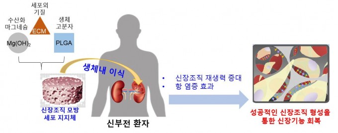 실제 신장조직 구조를 모방한 지지체를 개발해 손상된 신장의 재생을 촉진시키는 과정. -사진 제공 한국연구재단