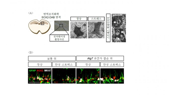 (A)스트레스를 겪은 성체 생쥐의 해마신경줄기세포에서 오토파지의 특징인 오토파고좀(동그란 구조)가 보인다. (B) 보통 쥐와 신경줄기세포를 자가포식하도록 하는 유전자 Atg7를 없앤 쥐에게 7일간의 만성 구속 스트레스를 겪게 했다. 염색을 통해 확인한 결과 신경줄기세포가 눈에 띄게 줄었다(왼쪽 두 번째). 하지만 Atg7 유전자 결손 쥐는 신경줄기세포 수가 줄지 않았다(맨 오른쪽). 사진제공 DGIST