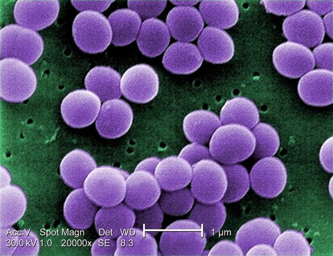 프랑스 연구팀이 황색포도상구균이 내놓는 독소 분자를 변형해 새로운 항생물질을 개발했다. 사진은 보라색으로 염색한 황색포도상구균을 주사전자현미경으로 2만 배 확대해 관찰한 것. 미국 질병통제예방센터(CDC) 제공