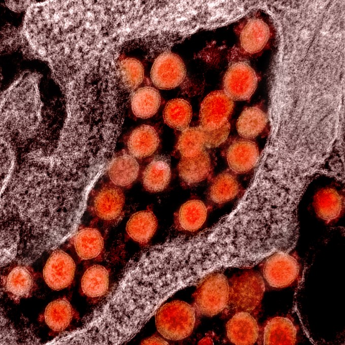 신종 코로나바이러스 감염증(코로나19)을 일으키는 사스코로나바이러스-2(SARS-CoV-2)의 전자현미경 사진이다. NIAID 제공