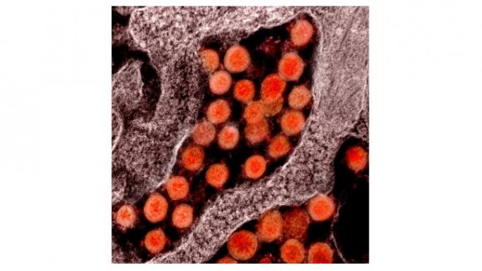 신종 코로나바이러스 감염증(코로나19)을 일으키는 사스코로나바이러스-2(SARS-CoV-2)의 전자현미경 사진이다. NIAID 제공