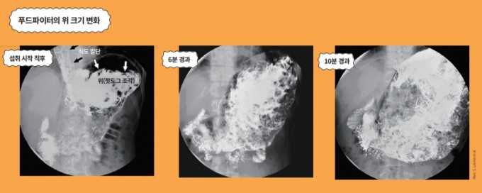 전문 푸드파이터가 10분 동안 36개의 핫도그를 먹을 때의 위장 변화를 형광 투시 기법으로 촬영한 사진. 핫도그를 연이어 섭취하자 위는 상복부에서 확장되기 시작했으며, 10분 뒤에는 상복부의 대부분을 차지할 정도로 엄청나게 팽창했다. 그동안 위는 소화를 위한 연동운동을 거의 하지 않았다. Marc S. Levine et al. 제공