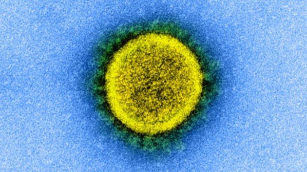 코로나19를 일으키는 사스코로나바이러스-2(SARS-CoV-2)의 현미경 사진. NIAID 제공
