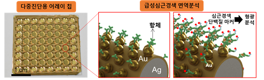 ㅇ