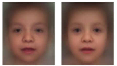 얼굴사진 분석해 희귀 유전질환 진단하는 AI 등장