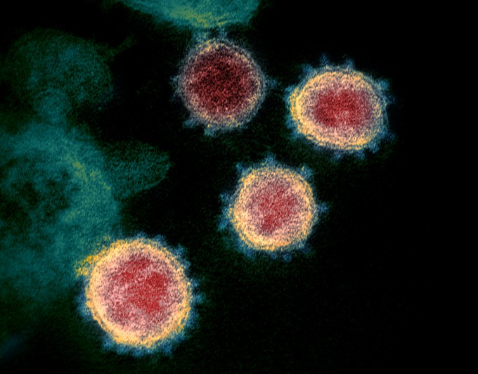 투과전자현미경(TEM)으로 촬영한 코로나19 바이러스의 모습. 국립알레르기전염병연구소(NIAID) 제공