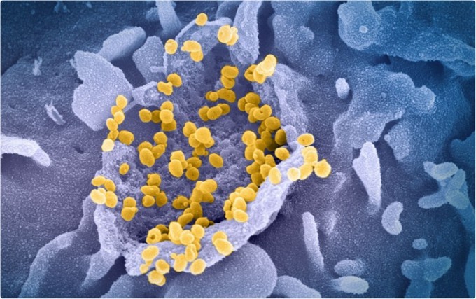 투과전자현미경(TEM)으로 촬영한 코로나19 바이러스. NIAID 제공