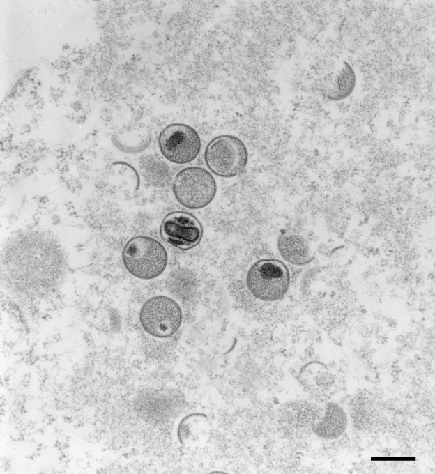원숭이 두창 바이러스를 독일 로베르트 코흐 연구소(RKI)가 2004년 전자현미경으로 촬영한 사진. 세계보건기구(WHO)는 이날 현재까지 영국 내 20건을 포함해 유럽과 미국, 호주, 이스라엘 등 12개국에서 92건의 감염과 28건의 감염 의심 사례가 보고됐다고 밝혔다. 로베르트 코흐 연구소 제공.