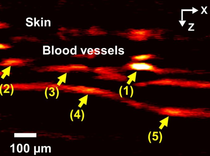 김철홍 포스텍 교수팀이 광혈류측정기와 광음향현미경을 이용해 손가락 혈관(빨간색) 움직임을 촬용했다. 포스텍 제공