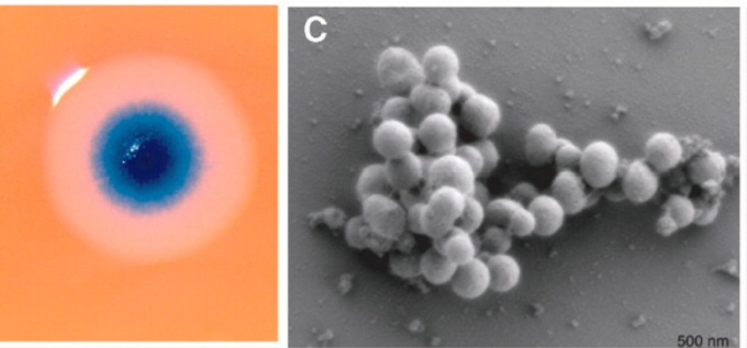 지난 2010년 과학자들은 인공생명체를 만들어 주목을 받았지만 무생물에서 생물을 창조한 건 아니다. 왼쪽은 화학합성으로 만든 인공게놈이 들어간 박테리아가 증식한 군집(콜로니)이고 오른쪽은 이를 현미경으로 들여다본 모습이다. 사이언스 제공