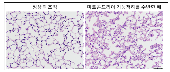  미토콘드리아 기능 저하에 따른 쥐의 폐조직 변화. 한국연구재단 제공