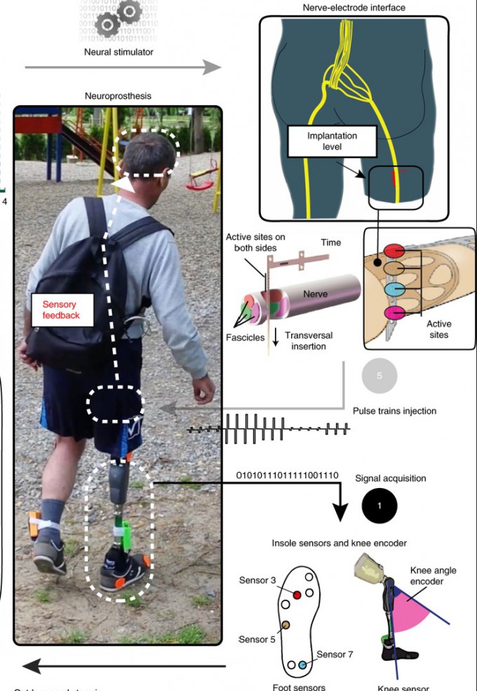 잃어버린 다리를 대신하는 의족은 어느 정도 기능을 수행하지만 환지통, 넘어질 위험성, <BR>무게감 등 여러 문제가 있다.<BR> 의족이 땅에 닿을 때 정보를 신경에 전달하는 감각 피드백 장치로 체화 정도를 높인 의족을 쓰면 이런 문제들을 상당 부분 해결할 수 있다.<BR> 네이처 의학 제공