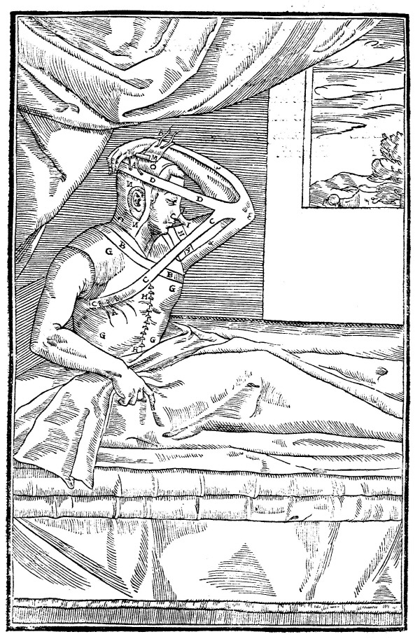 가스파레 탈리아코치의 ″(이식에 의한 절단 수술에 관한)″(1597)의 드 커르토룸 치루르지아의 조각. 위키미디어 제공