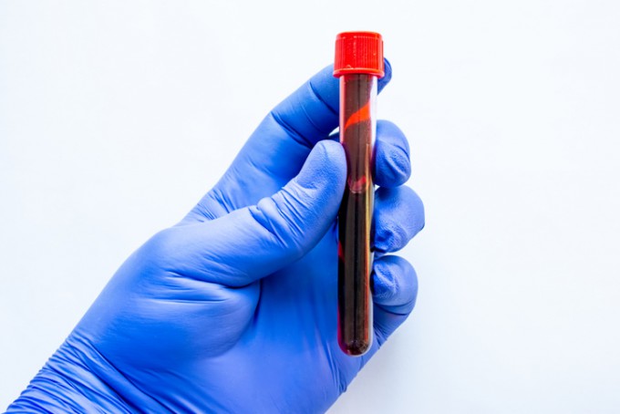 can semaglutide be detected in a blood test GLP-1 Lab Requirements: What Tests You Need Before Starting Does Semaglutide Show Up in