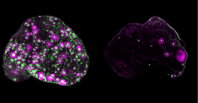 왼쪽은 생후 2개월 된 생쥐의 난소, 오른쪽은 12개월 된 생쥐의 난소다. 녹색으로 표시된 점은 난자를 품은 ‘난포(follicle)’이며 나이가 들수록 그 수와 밀도가 눈에 띄게 줄어든다. 분홍색 부분은 성장 중인 난포를 나타낸다. Gaylord, et al. Science 제공