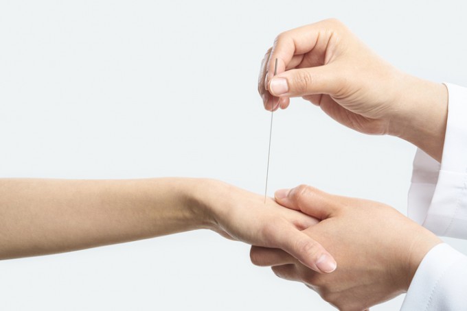 통증 부위 반대편에 침을 놓는 ′거자 침법′의 과학적 효과가 처음으로 확인됐다. 게티이미지뱅크 제공