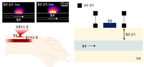 피부에 AI 무선 전자패치 붙여 혈류 상태 실시간 측정 - 동아사이언스