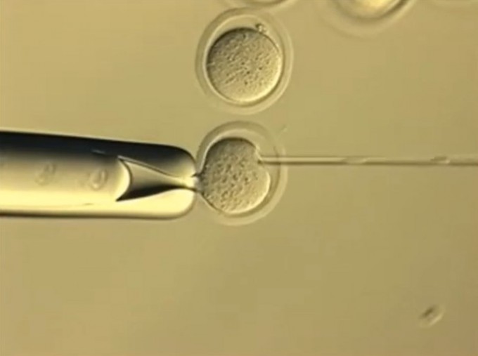 체세포의 핵을 생쥐 난자에 이식하는 핵이식 복제 과정. 야마나시대 제공