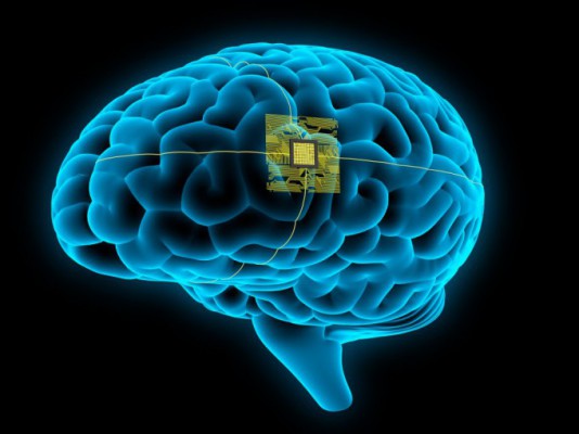 中, AI 적용한 뇌 삽입장치 상용화 박차…가전 조작·분당 300자 해독