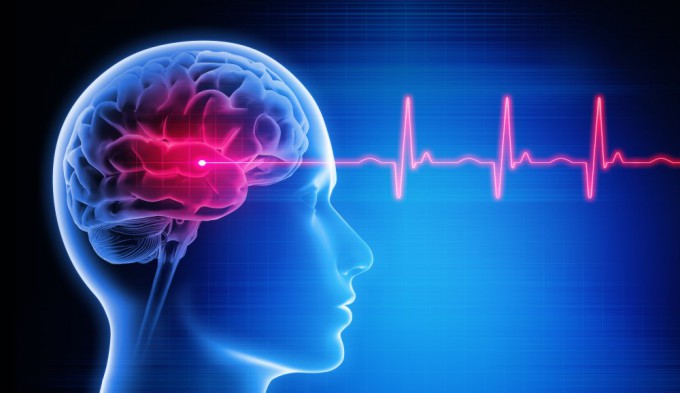 A Korean research team has developed AI that objectively analyzes pain based on brain waves (EEG). Provided by Getty Images Bank.