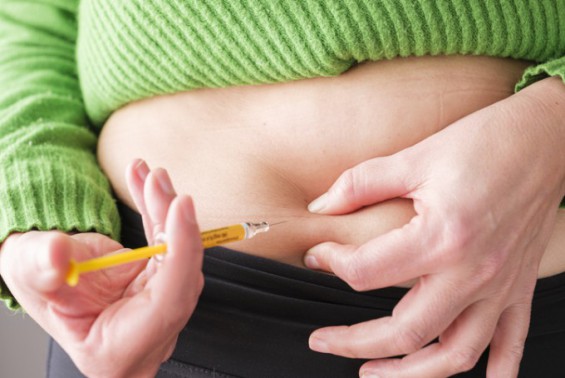 glp 1 amgen A GIPR antagonist conjugated to GLP-1 analogues promotes weight loss with improved metabolic parameters in preclinical and phase settings ADA: Amgen talks Repatha, GLP-1