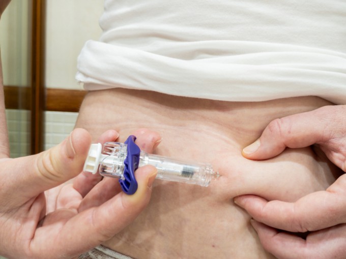 GLP-1 obesity drugs activate hunger neurons to drive fat loss