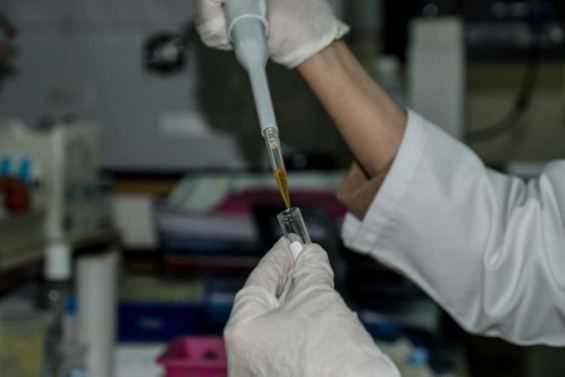 China Dominates Global In Vivo CAR-T Therapy Development - News Directory 3