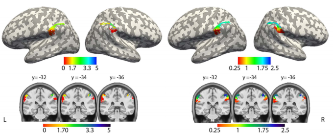 INSERM and CEA map how the human brain aligns integers and fractions on ...