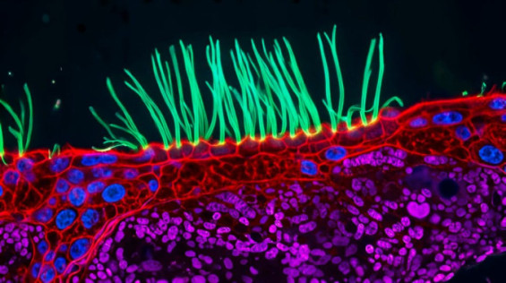 Nikon Small World in Motion 2026 winner sparks AI manipulation dispute ...